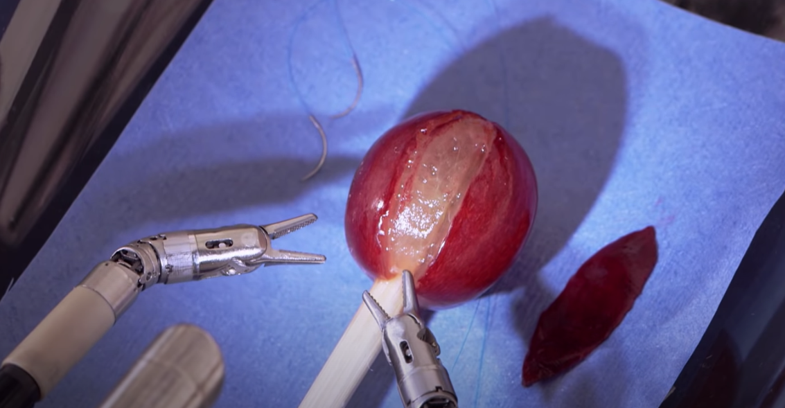 Read more about the article Conheça mais sobre a cirurgia robótica